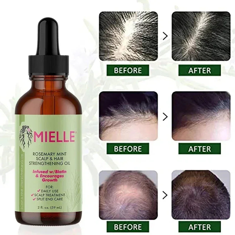 Mielle Rosemary Mint Scalp & Hair Strengthening Oil – Nourishes, Repairs Split Ends, and Promotes Healthy Hair Growth