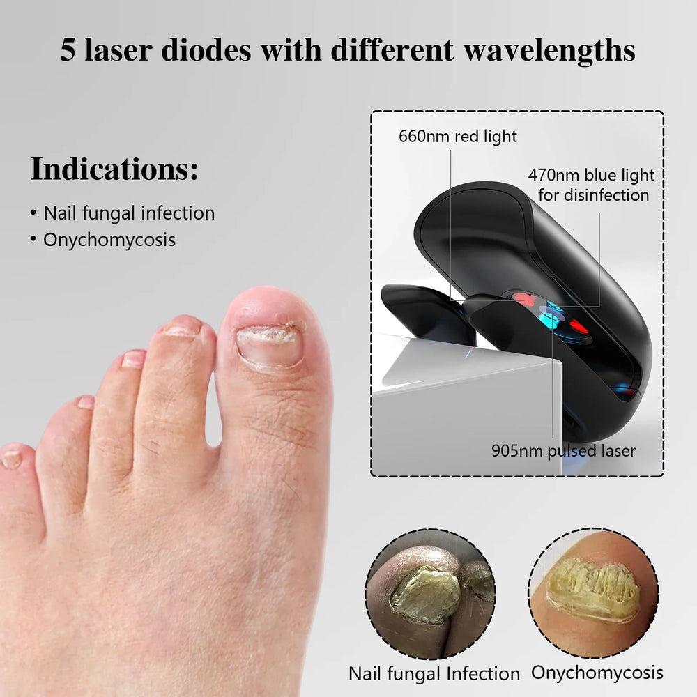 905NM Nail Fungus Laser Nail Treatments Device USB Charging Light Therapy for Fingernails Toenails Onychomycosis Cure Machine
